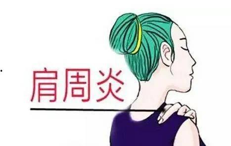肩周炎爬墙视频,跟随爬墙视频，轻松缓解肩部疼痛