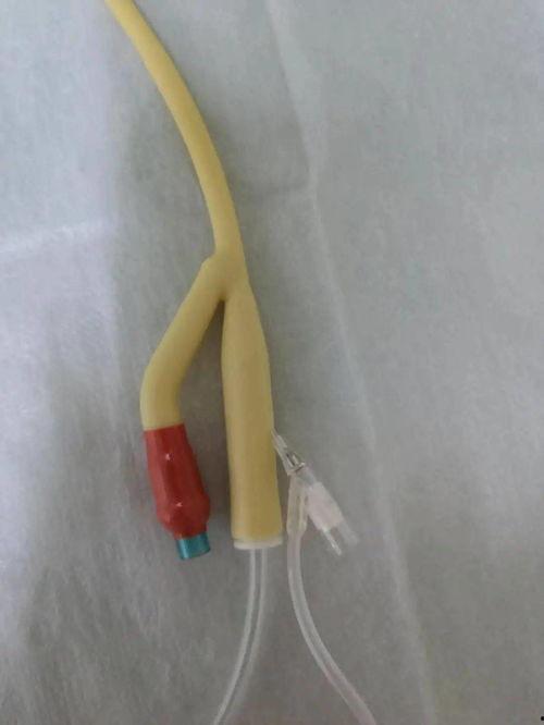 膀胱冲洗操作视频,步骤与技巧全解析
